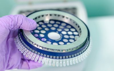 Les tests par RT-PCR sont-ils pertinents pour évaluer une évolution épidémique, et prendre des mesures en conséquence ?